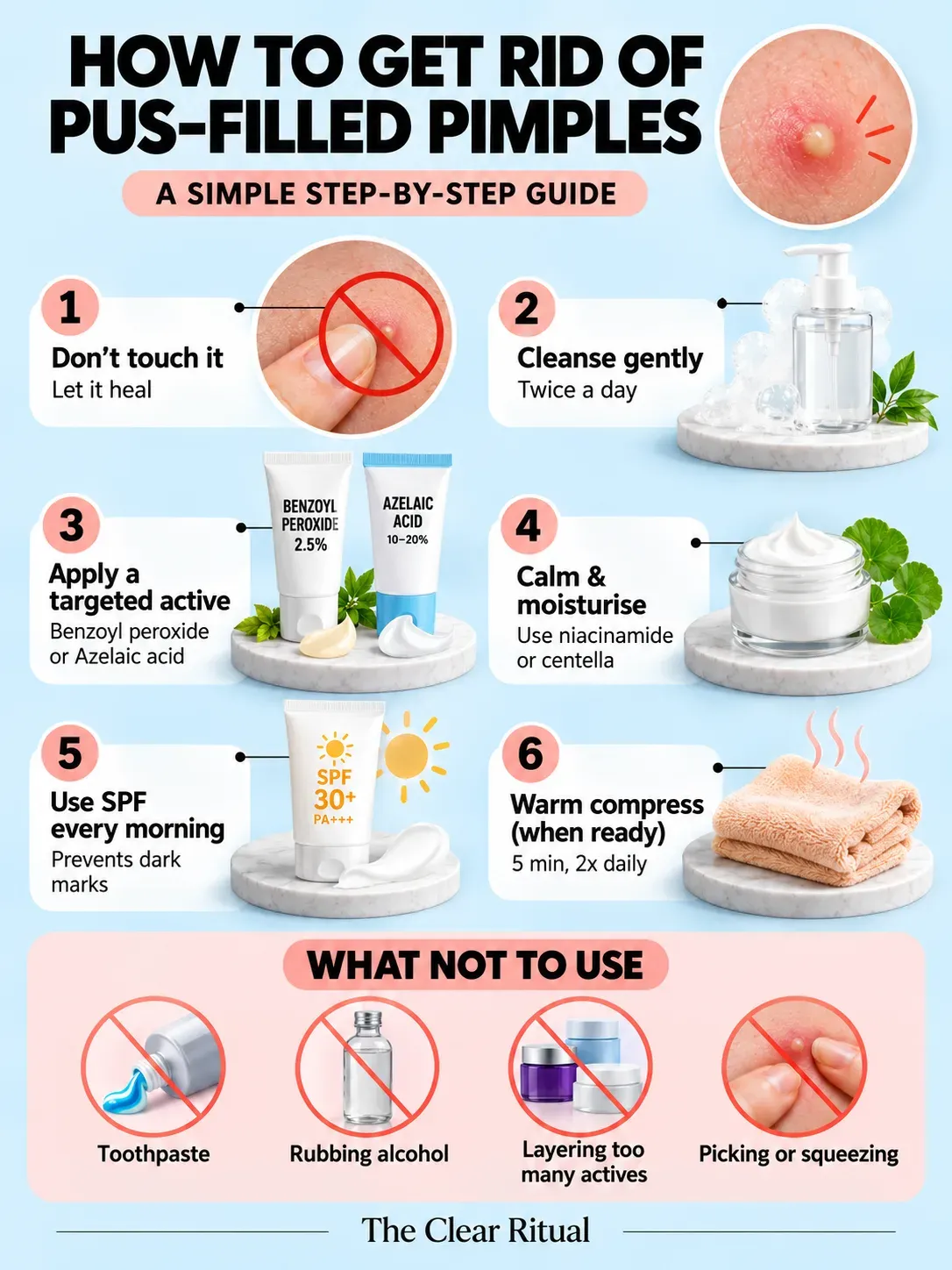 Infographic on how to get rid of pus-filled pimples