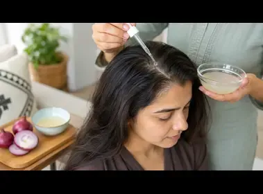 Fresh onion juice being applied to the scalp as a home remedy for hair growth