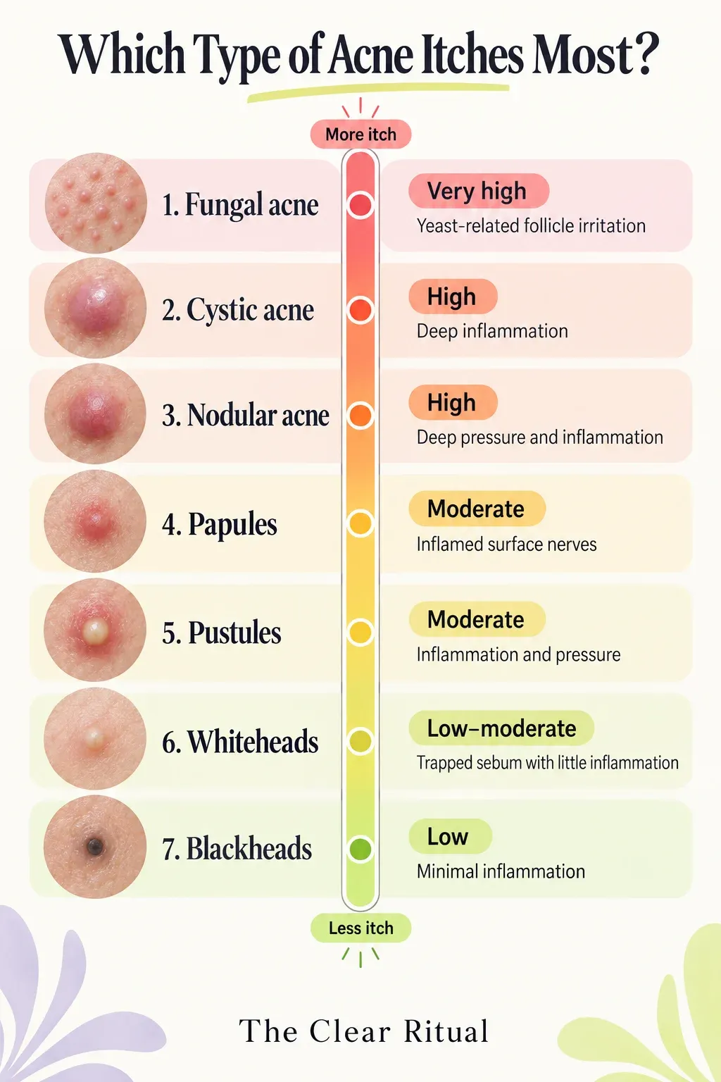 Comparison of acne types by itch intensity
