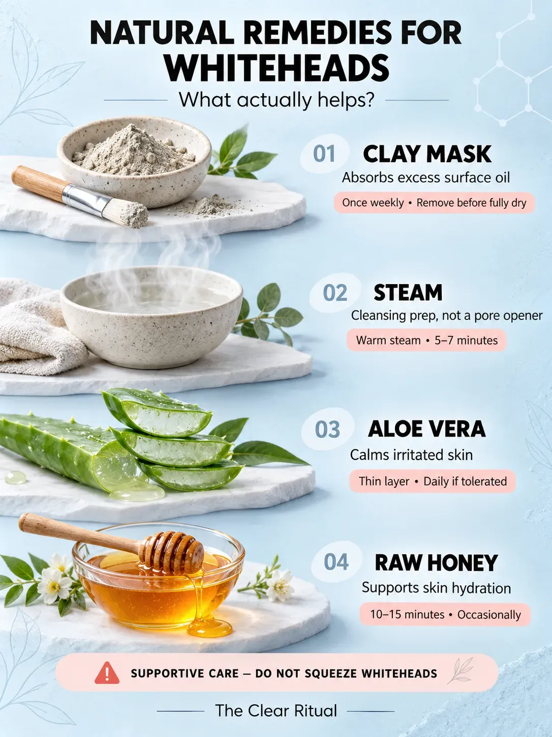 Natural home remedies for whiteheads