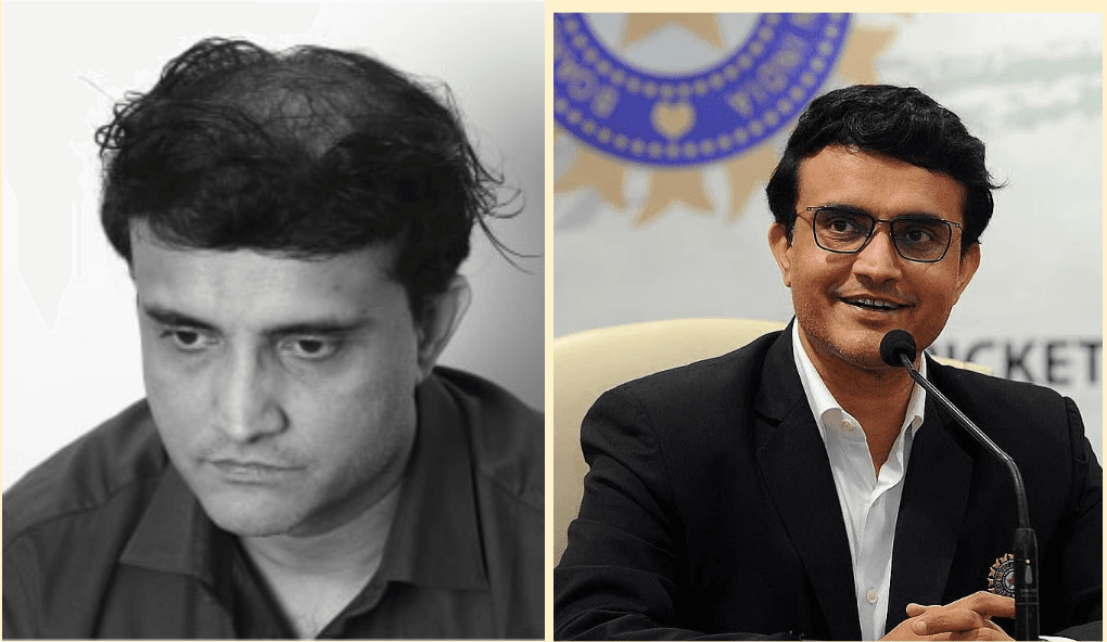 sourav ganguly before and after.png